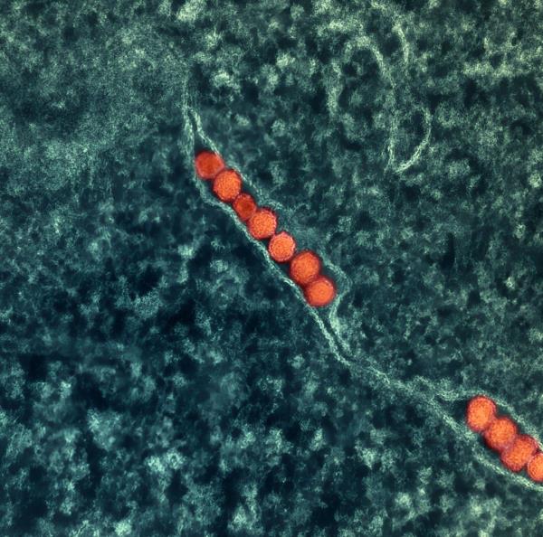 A transmission electron micrograph of West Nile virus particles.
