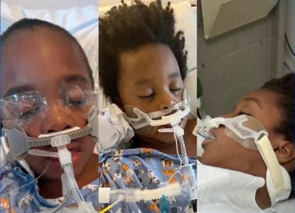 The three kids who are on ventilators after a fire torched their Brooklyn apartment.