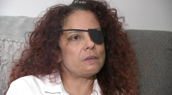 Suyapa Ramos with eye patch