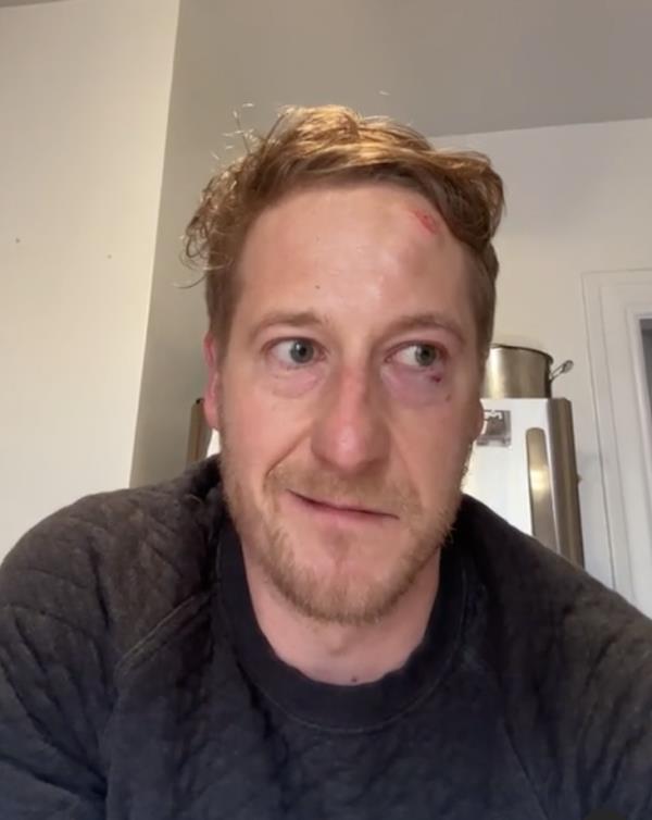 Harter took to Instagram to recount the terrifying encounter.