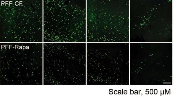 New findings a<em></em>bout key pathological protein in Parkinson's disease open paths to novel therapies